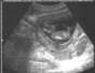 Our baby at 12 weeks