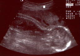 Our baby at 21 weeks